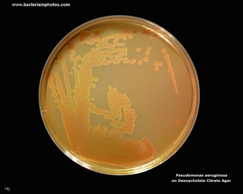 deoxycholate citrate agar pseudomonas